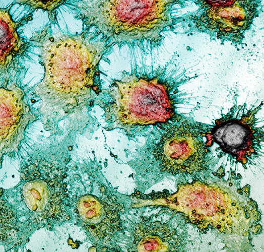 Morphological surface analysis to study cell viability